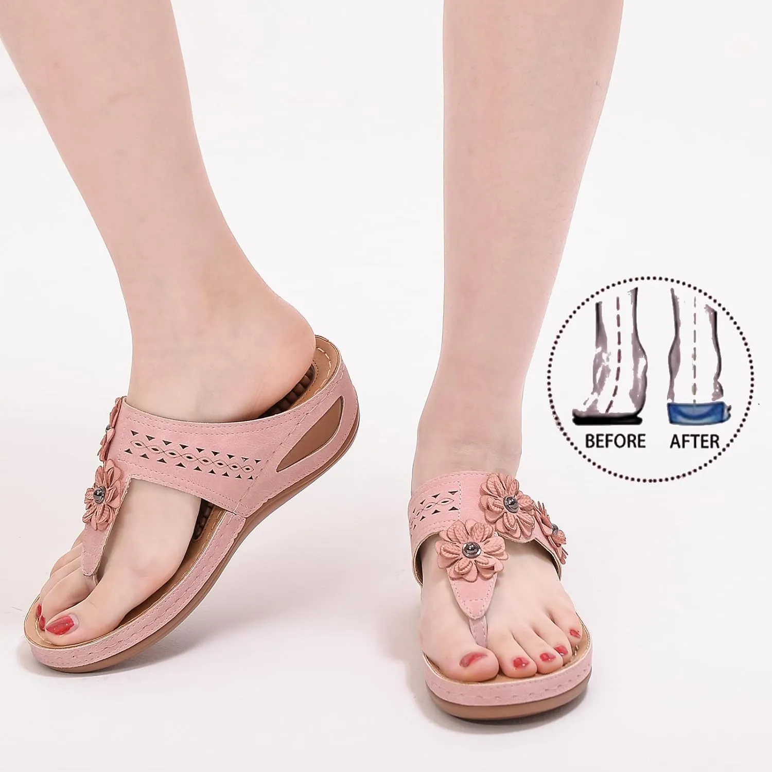Sandals for Women Wedge Shoes Comfortable Orthopedic Sandals, Womens Dressy Summer Flip Flops Platform Footwear Casual Walking Wedges Flower Orthopedic Flip Flops